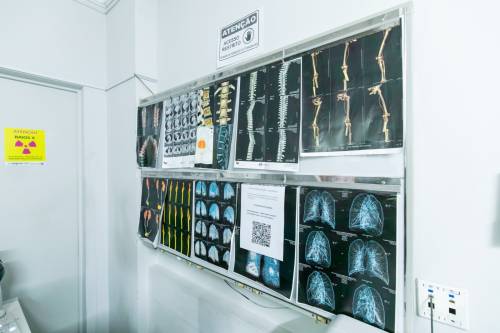 Saúde de Cuiabá já oferece mamografia e ressonância para mulheres